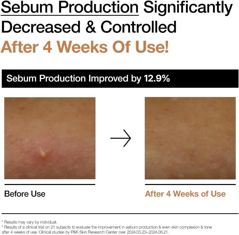 image:imageANUA Rice 70 Glow Milky Toner for Glass Skin Rice Water Niacinamide Ceramides Panthenol FragranceFree Non comedogenic Fungal Acne Safe Korean Skin Care 250ml845floz