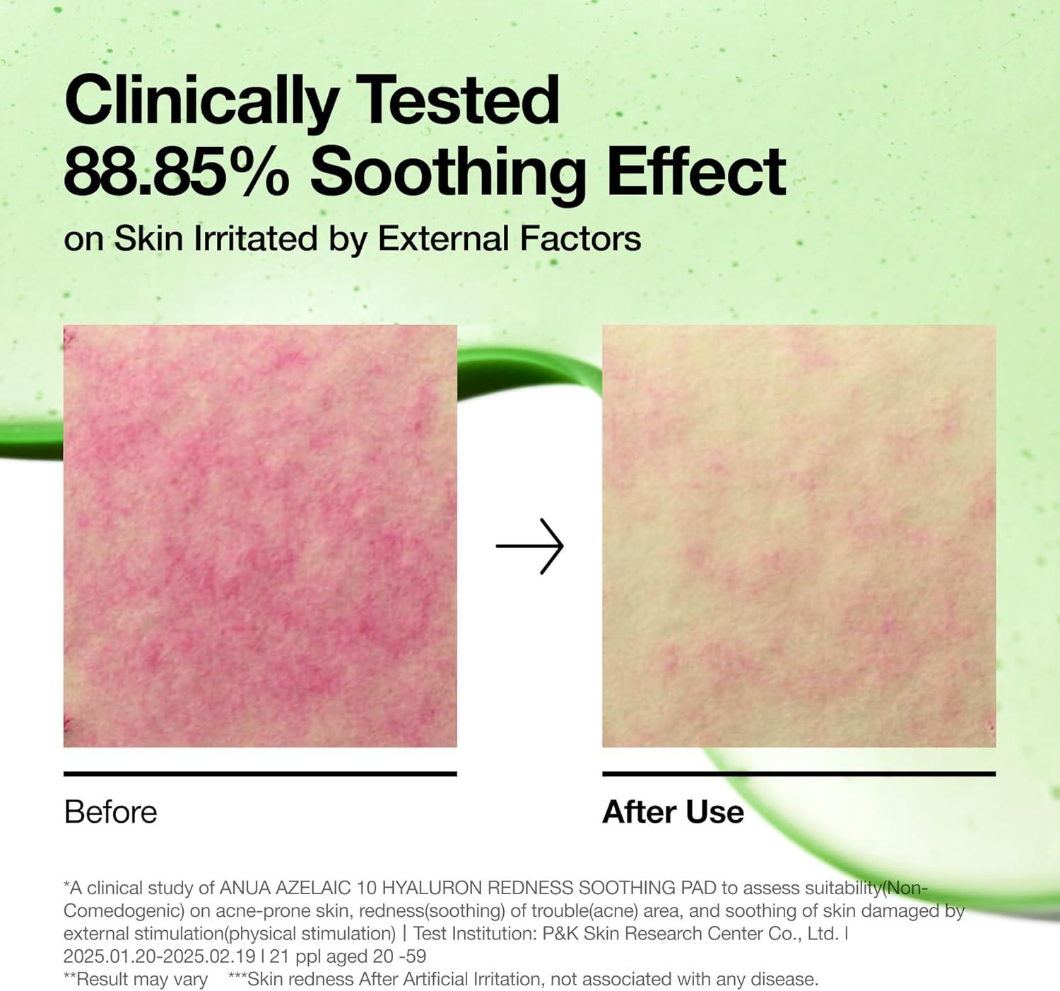 image:imageAnua Niacinamide 5 TXA Toner Pads Hydrating Facial Pad for Daily Care Undereye with Tranexamic acid Korean Skin Care 210ml 60 PadsAzelaic Acid