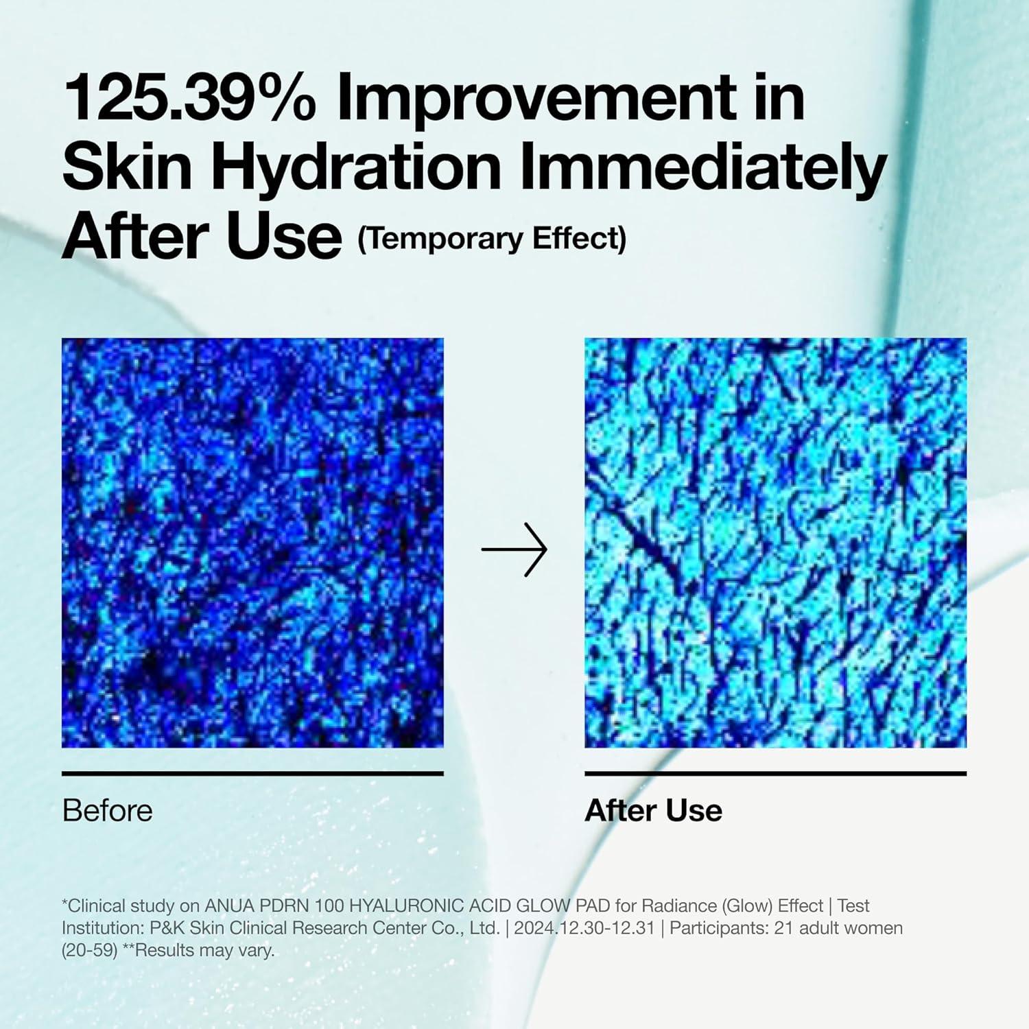 image:imageAnua Niacinamide 5 TXA Toner Pads Hydrating Facial Pad for Daily Care Undereye with Tranexamic acid Korean Skin Care 210ml 60 PadsPDRNSalmon DNA