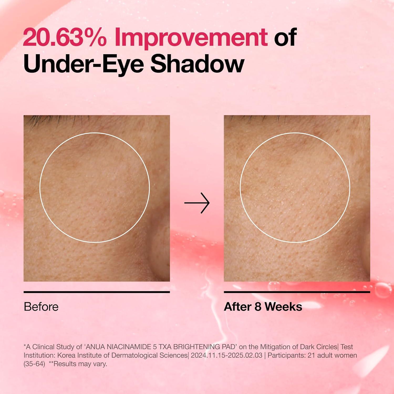 image:imageAnua Niacinamide 5 TXA Toner Pads Hydrating Facial Pad for Daily Care Undereye with Tranexamic acid Korean Skin Care 210ml 60 PadsTXA Niacinamide