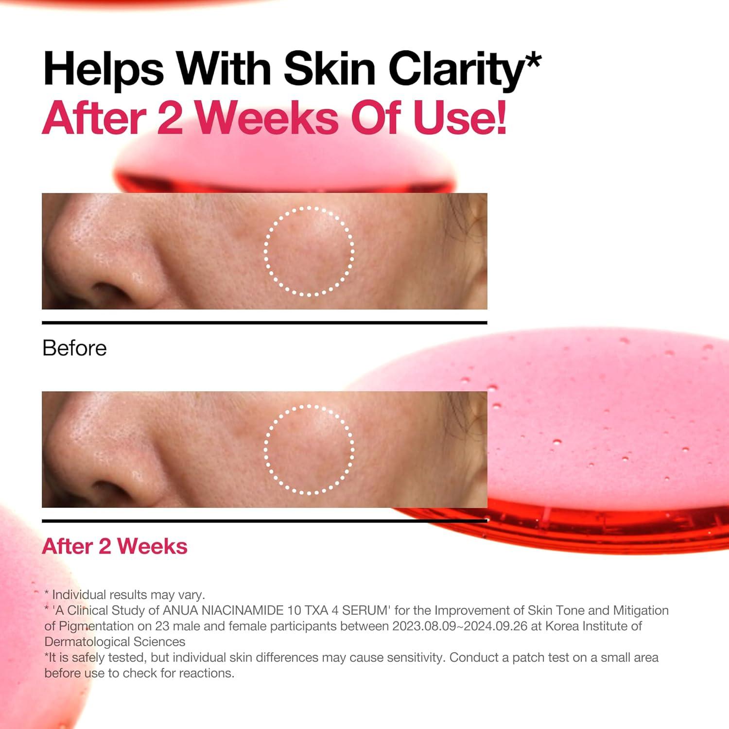 image:imageAnua Niacinamide Dark Spot Prep amp Boost Duo Mini Sheet Face for Skin Clarity Tranexamic acidHyaluronic Acid for glass skin Glow radiance synergy Day amp Night Routine Korean skincare set