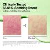 Anua Azelaic Acid Redness Soothing Prep & Boost Duo, Soothing & Calming Synergy, Spot care with Mini Sheet mask for Day & Night Routine, Korean skincare set