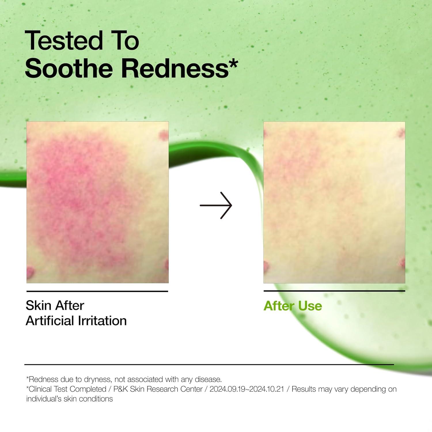 image:imageAnua Ultimate Spot Duo Niacinamide 10 TXA 4 Serum amp Azelaic Acid 10 Hyaluron Redness Soothing Serum Early amp Post Spot Care Skin Clarifying Natural Color Korean Skincare Set
