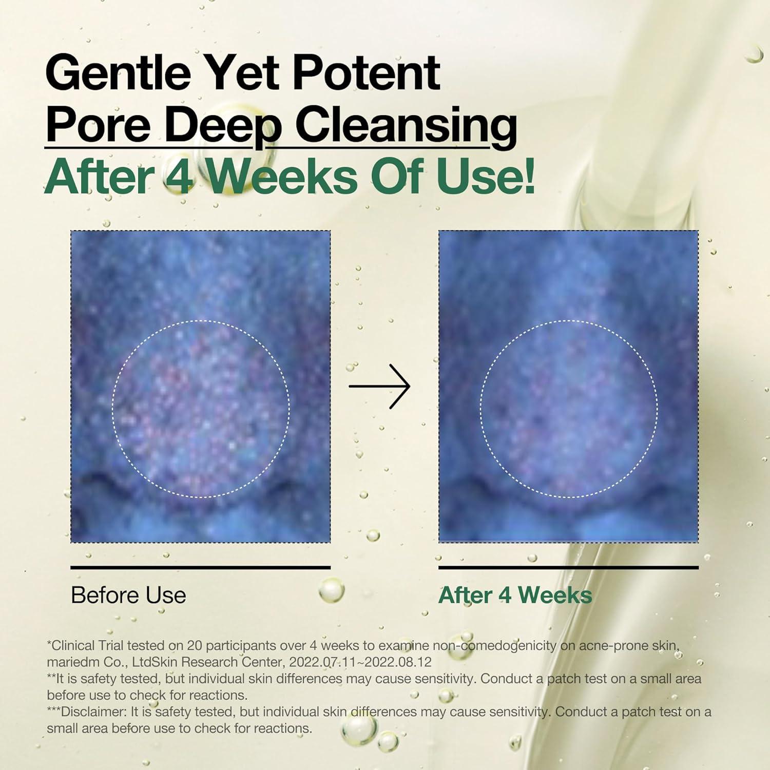 image:imageAuna Deep Pore Treatment Duo Heartleaf Pore Control Cleansing Oil Heartleaf 77 Toner Pad Exfoliating Facial Pads AfterCleansing for Gentle Facial Care Korean Skincare Set