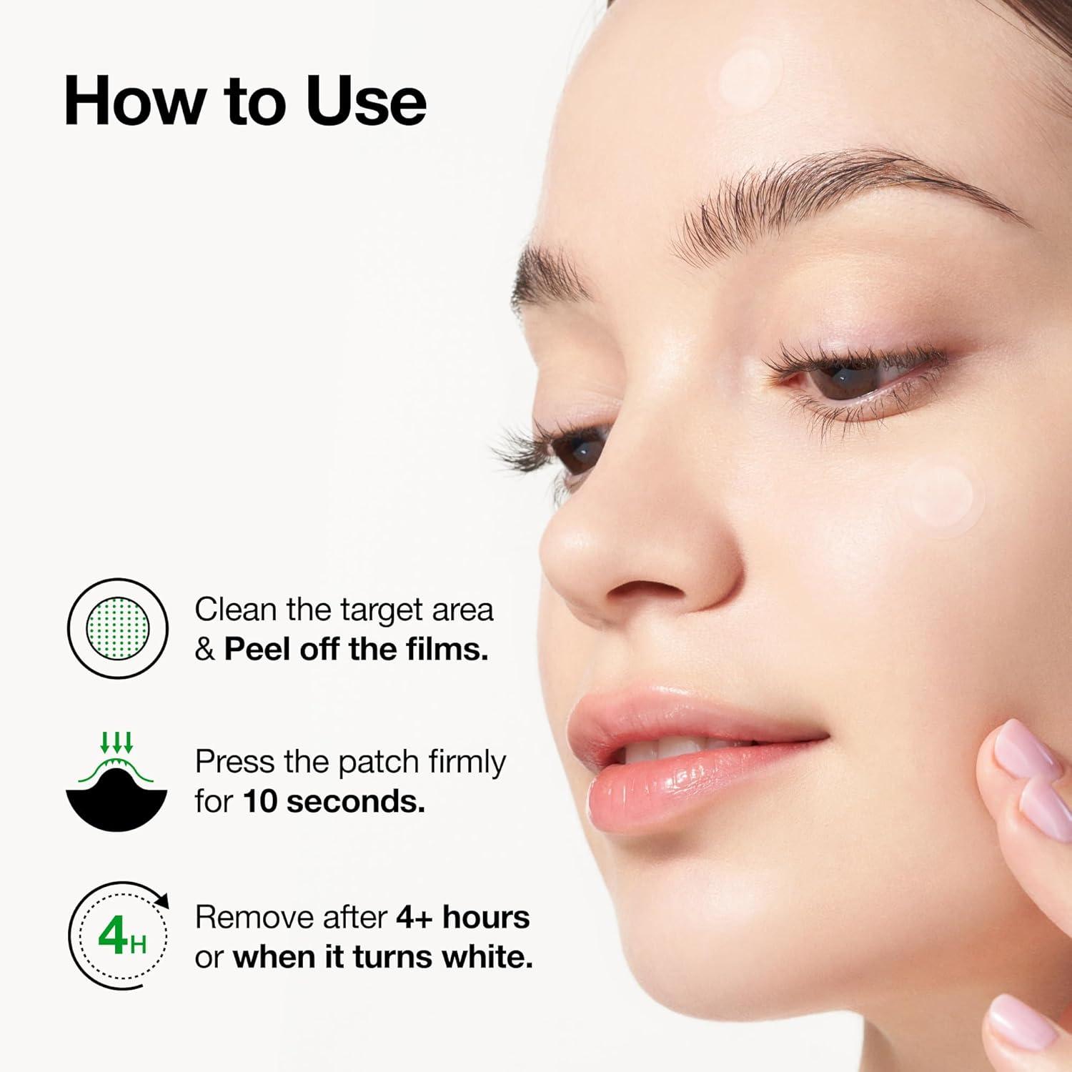 image:imageAnua Triple Acid Spot Care Microdart Patch Early Stage Spot 200 Microdarts with AHA BHA PHA Centella Hydrocolloid Patch for Overnight NonComedogenic Korean Skincare 12 ea